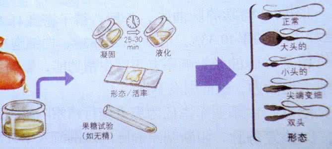 精子不液化影响生育吗 精子不液化影响生育吗 A级精子是什么意思？A级精子少会影响生育吗