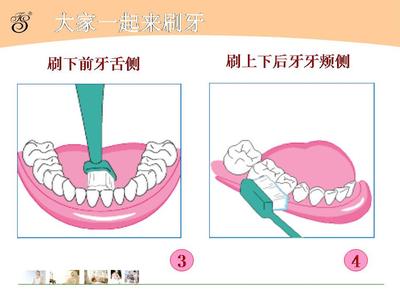 口腔自检 图解：一套口腔健康自检题▕  宠爱牙齿必做的事
