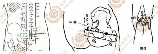 艾灸治疗坐骨神经痛 臀上神经痛的艾灸方法