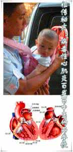 病毒性心肌炎症状 祖传秘方：病毒性心肌炎百发百中玉竹丹参饮