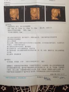 胎儿双顶径和股骨长 32周胎儿双顶径股骨长看男女科学吗