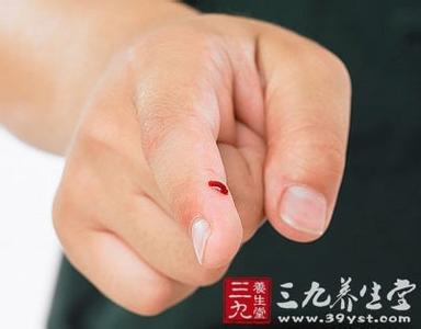 伤口传播梅毒的误区 伤口处理的5个误区