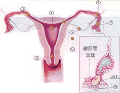 宫颈妊娠 宫颈妊娠 宫颈妊娠如何预防