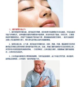 咽炎患者晨起症状 晨起如有以下列症状,说明您的身体已经不健康了!