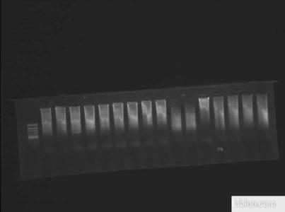 pcr电泳条带分析 pcr电泳条带分析 临床检验仪器与技术试验指导(电泳+PCR)
