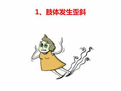 脑血栓 八大脑血栓先兆