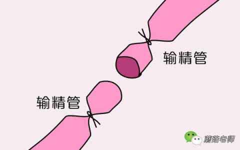 带环避孕的原理 女人带环怎么避孕 原理是什么