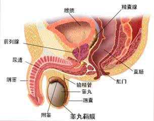 前列腺钙化灶的治疗 前列腺钙化灶 前列腺钙化灶的治疗与预防