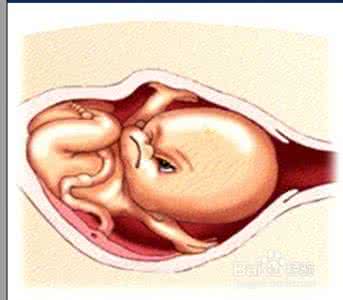 胎儿窘迫 胎儿窘迫 胎儿窘迫怎么办