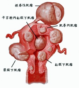 剖腹产能做人流吗 剖腹产能做人流吗 剖宫产能保持产后体形吗？