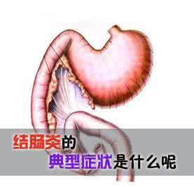 结肠炎的临床表现 什么是结肠炎 这些表现就是结肠炎