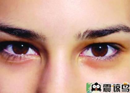 眼睛重影会不会恢复 眼睛重影是怎么回事