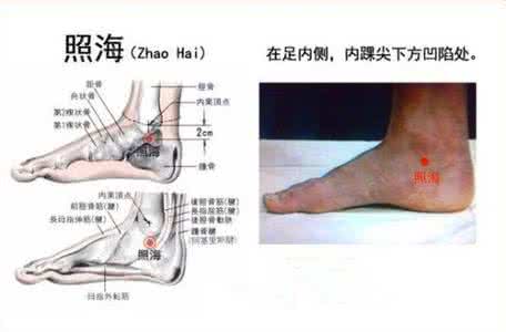 失眠多梦是肾虚吗 照海穴--告别咽痛和失眠的强肾降火妙穴--摘自《黄帝内经》家庭版