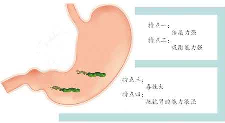 抑制幽门螺杆菌的食物 抑制幽门螺杆菌的食物 在家抑制幽门螺杆菌的3个方法，很简单，医生一般不告诉你