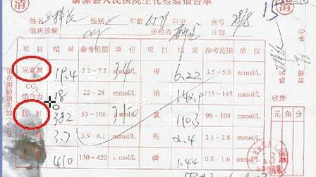 尿毒症专科医院 尿毒症专科医院 尿毒症专方