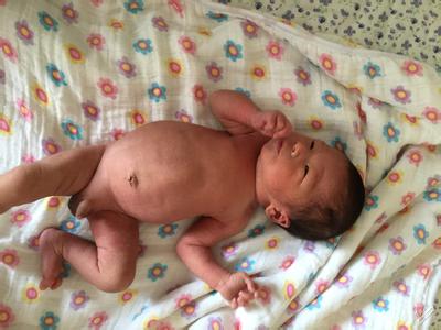 新生儿肚子鼓鼓的还硬 新生儿肚子胀气怎么办