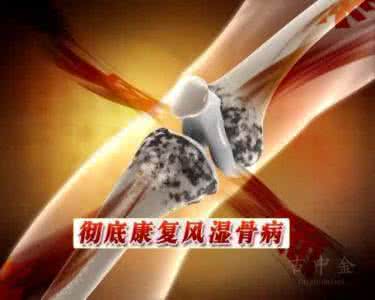 葱姜蒜 不花钱治关节炎——用葱姜蒜