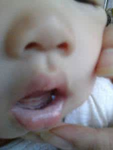 婴儿嘴唇发白无血色 宝宝嘴唇发白怎么办