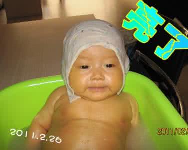 新生儿黄疸 图解：准妈妈必知！什么是新生儿黄疸