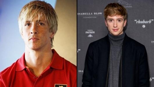 脸撞肿了怎么快速消肿 当世界遇上杭州，脸都撞肿了