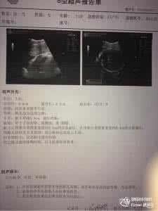 b超报告单怎么看 b超检查报告单怎么看 妊娠期B超检查要怎么看?