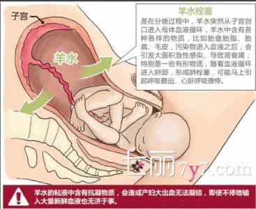 羊水栓塞的原因 羊水栓塞的原因 羊水栓塞