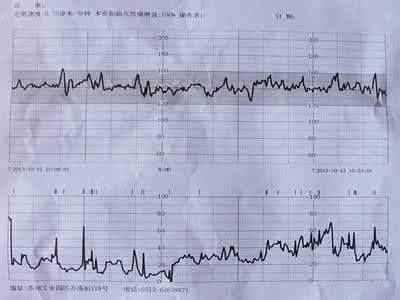 胎心监护做一次多少钱 什么是胎心监护