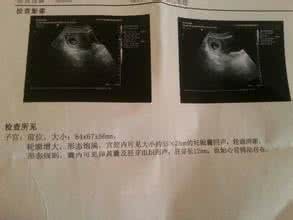 生男女的孕囊数据 从”孕囊“数据看出生男生女