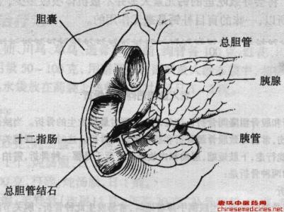 胆囊结石多大 第四十三节　胆石症