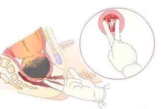 宫口是指哪个位置图片 什么是宫口