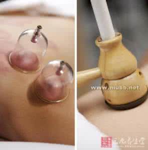 拔火罐后要注意什么 拔火罐要注意什么事情？