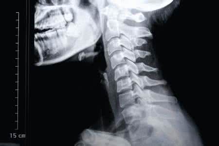 内耳眩晕症治疗方法 眩晕症---------输液高效方