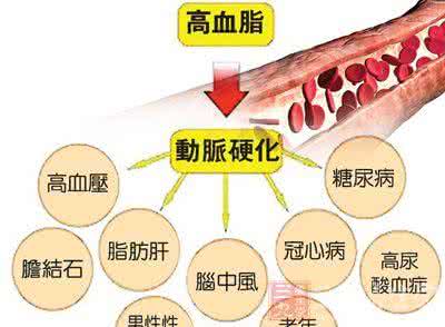 治疗高血脂的特效药 高血脂的危害 如何治疗高血脂