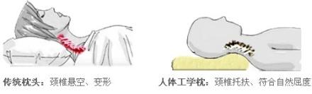 预防颈椎病的枕头 选个合适的枕头 预防颈椎病的六个小绝招