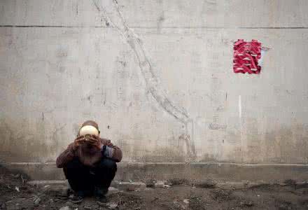 得什么病容易掉头发 不同地方的人爱得什么病