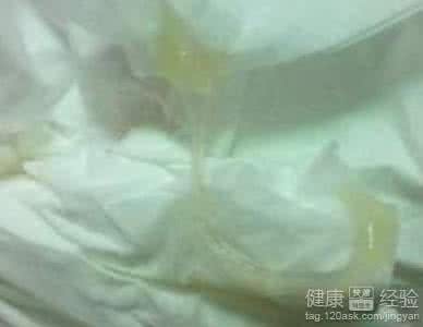 白带发黄的主要原因 女性的白带突然发黄是怎么回事？