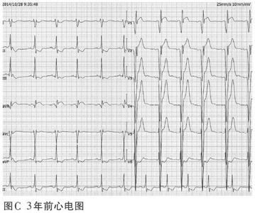 一条大河波浪宽 【读图解析】宽QRS波的障眼法