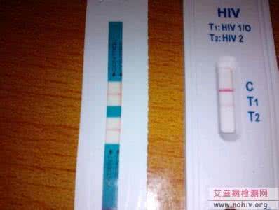 唾液艾滋病检测试纸 艾滋病检测试纸 艾滋病唾液检测试纸