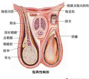 两性畸形 百度百科 两性畸形 百度百科 小儿两性畸形的预防