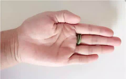 男性生殖器常见病症图 常见病症的自我治疗小妙招