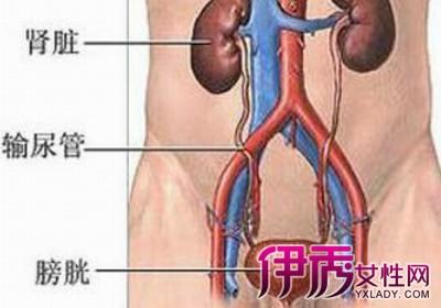 膀胱肿瘤早期预防 膀胱肿瘤是什么 膀胱肿瘤的治疗与预防