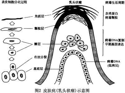 人乳头瘤病毒怎么得的 高危型人乳头瘤病毒 它的感染途径有哪些