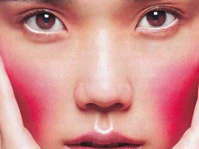 最简单的祛红血丝偏方 去红血丝的偏方