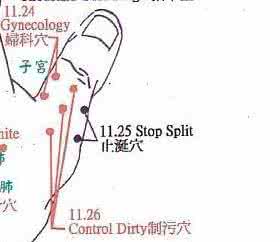 董氏针灸 (10)转载 董氏針灸解剖觀的發現與運用
