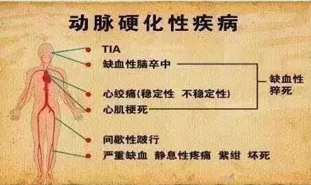 一碗汤让血管畅通 一天一碗，保护血管，远离一大半老年病，可自制~