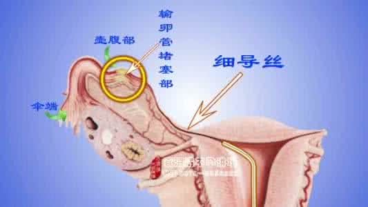 月经排卵正常 不孕 月经 排卵 怀孕 三者混淆致不孕