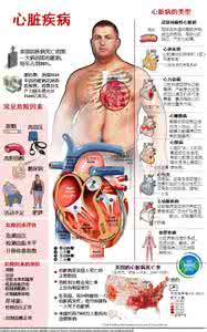 心脏病的类型 图解：心脏病的类型及危险因素