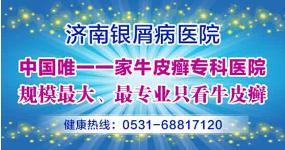 预防糖尿病十大要素 如何预防牛皮癣 5个要素早知道