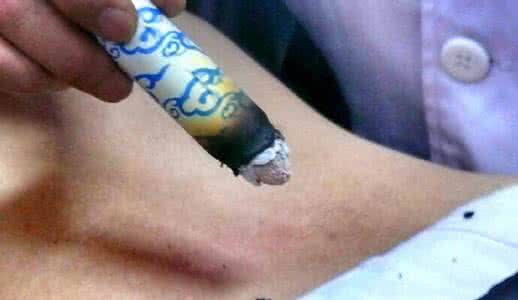 脚上长水泡 糖尿病患者脚上长水泡 脚上有一个穴位,是糖尿病患者的专用穴