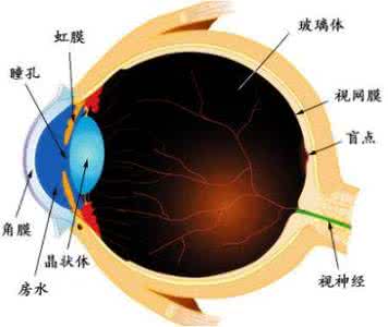 白内障过熟期 白内障长熟再治是误区